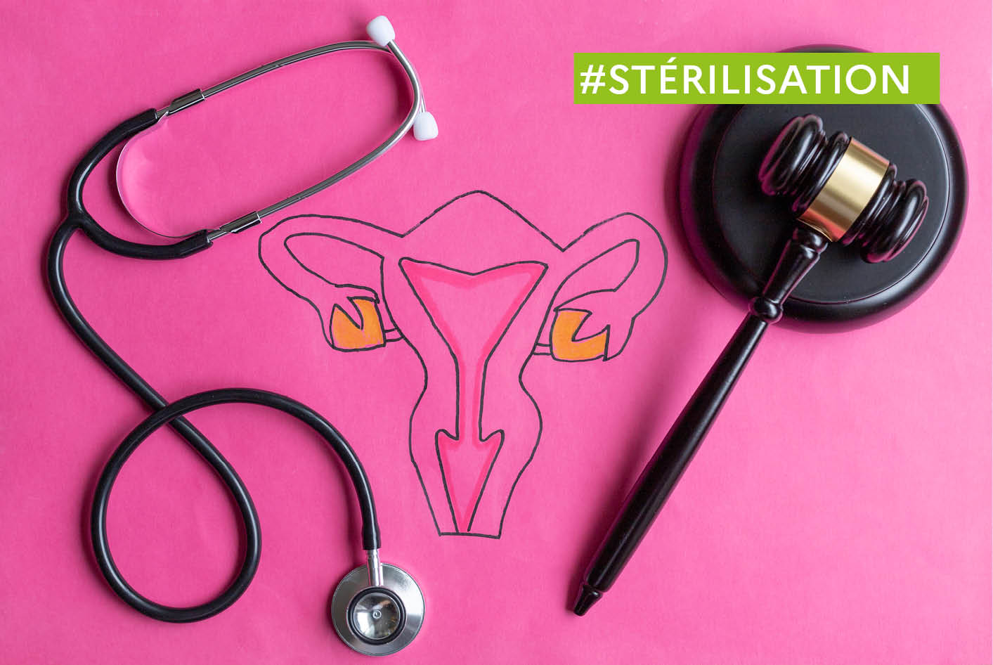 Stérilisation à visée contraceptive des personnes majeures protégées ...